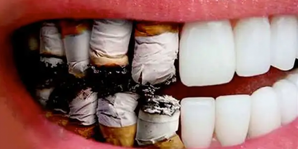¿Cómo son los dientes de un fumador? - Clínica la Paz