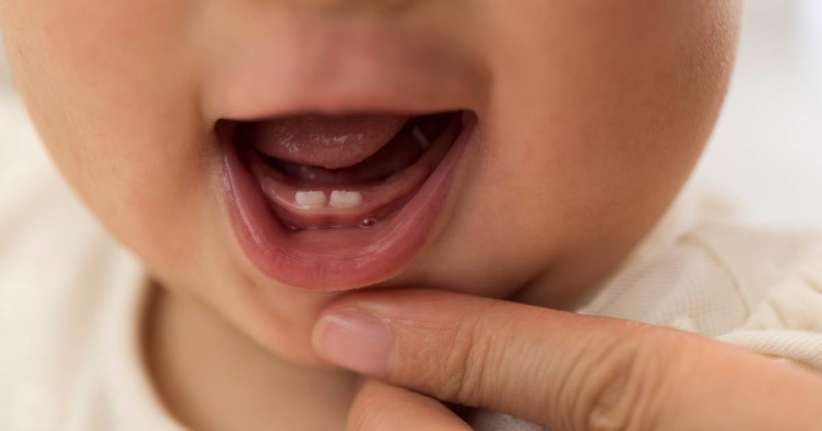 Dentición de bebés