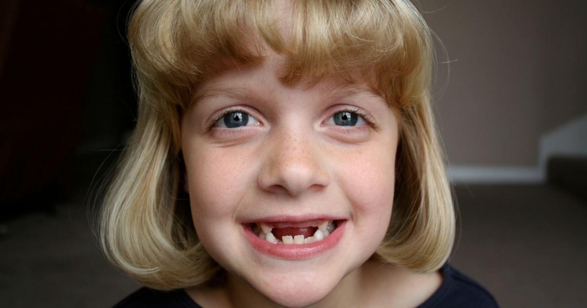 agenesia dental