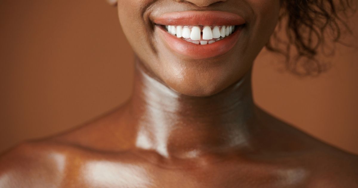 diastema