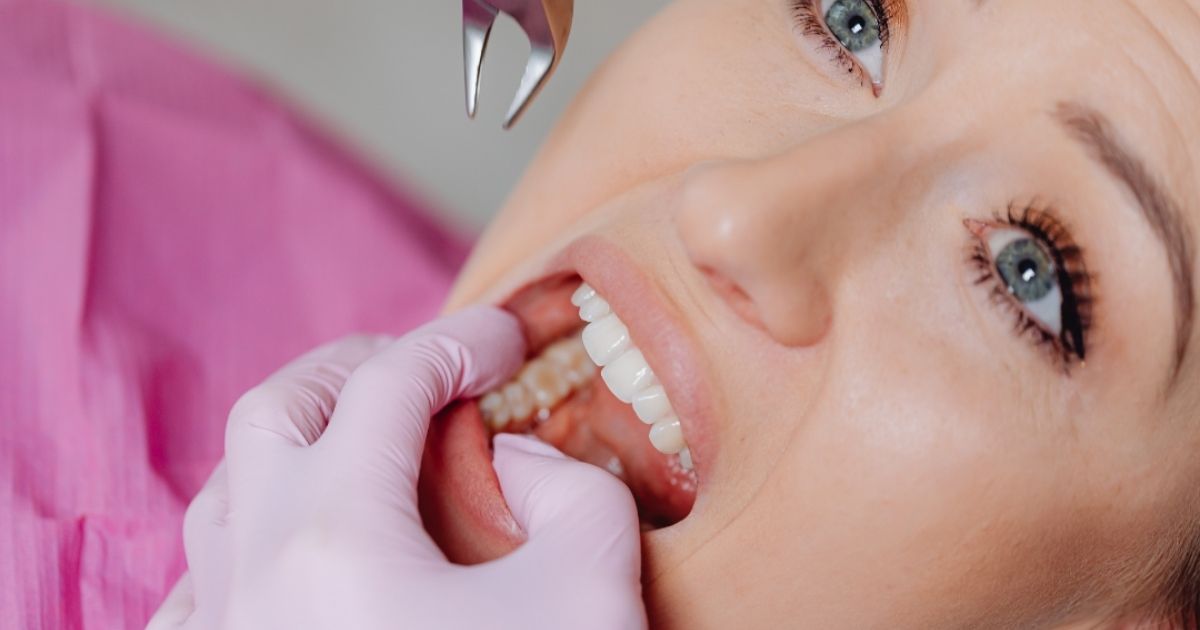 se puede salvar un diente flojo por periodontitis