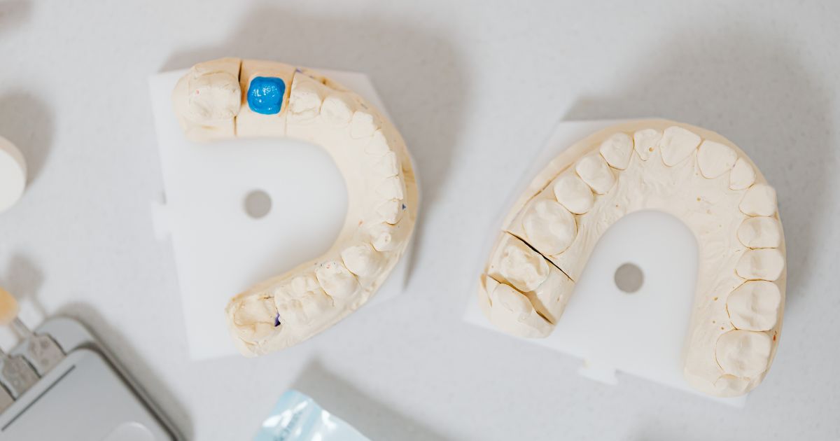 cuanto se tarda en hacer una reconstrucción dental