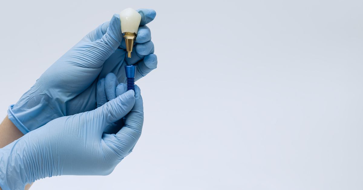 cuanto se tarda en poner una corona dental