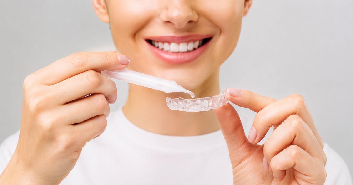 dientes amarillos